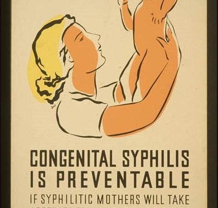 CDC Congenital Syphilis